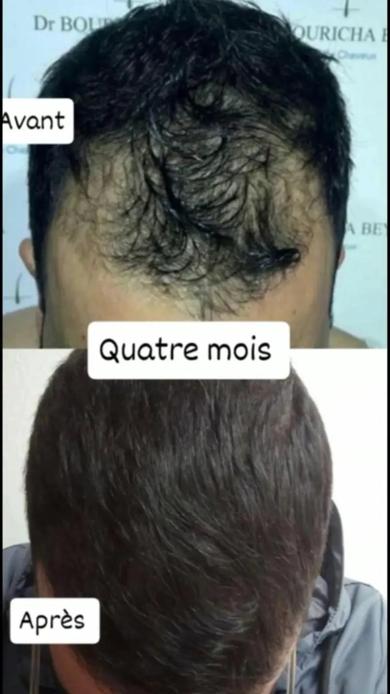 @Bouricha Beya
