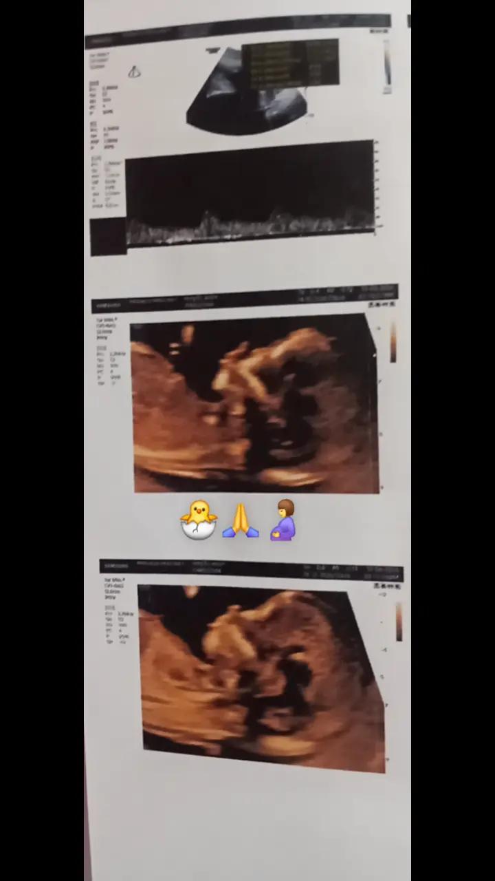 @Mi amor🐣🙏🥰
