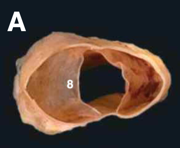 @Pasi&oacute;n por la Anatom&iacute;a