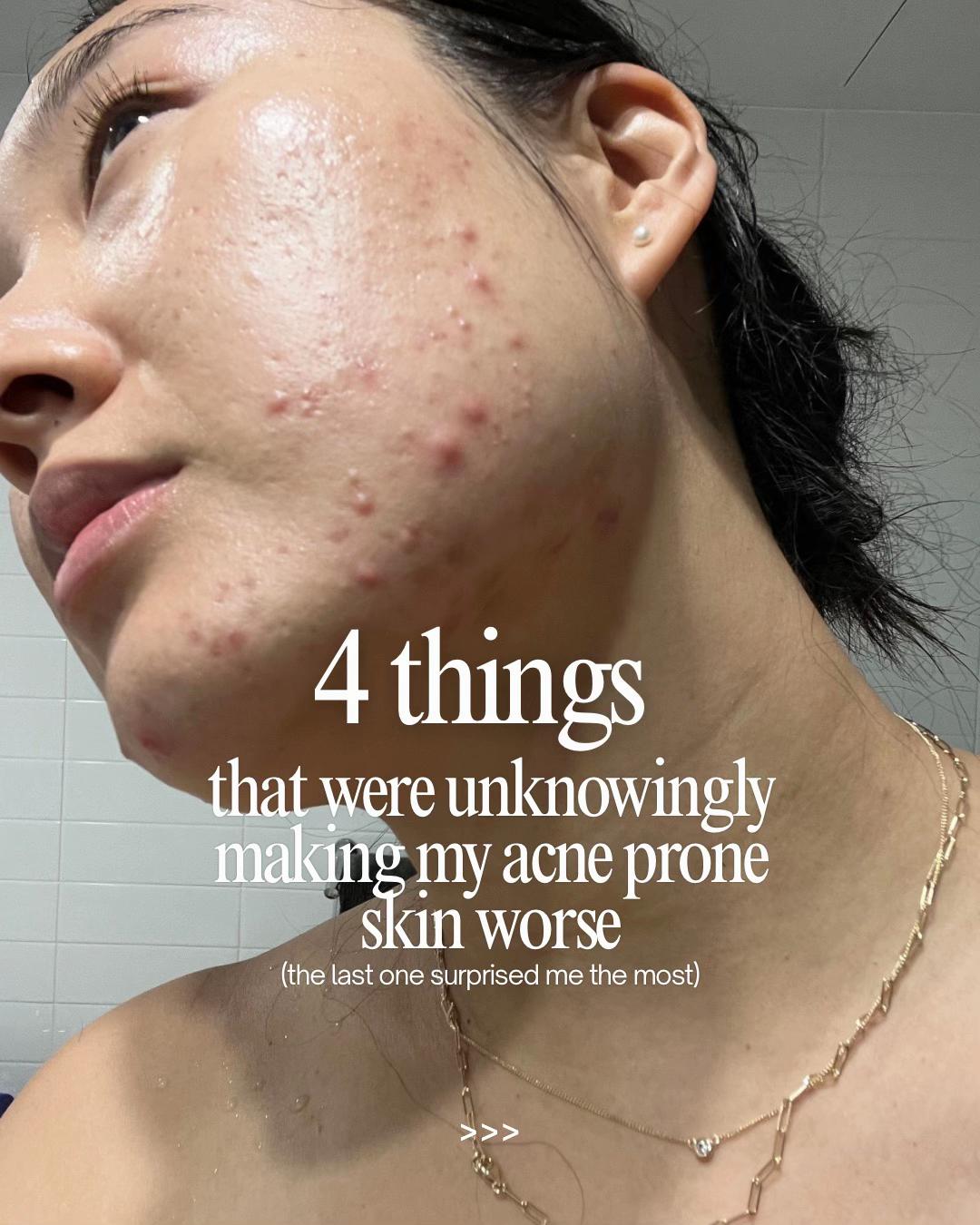 @Lisa | acne → clear skin