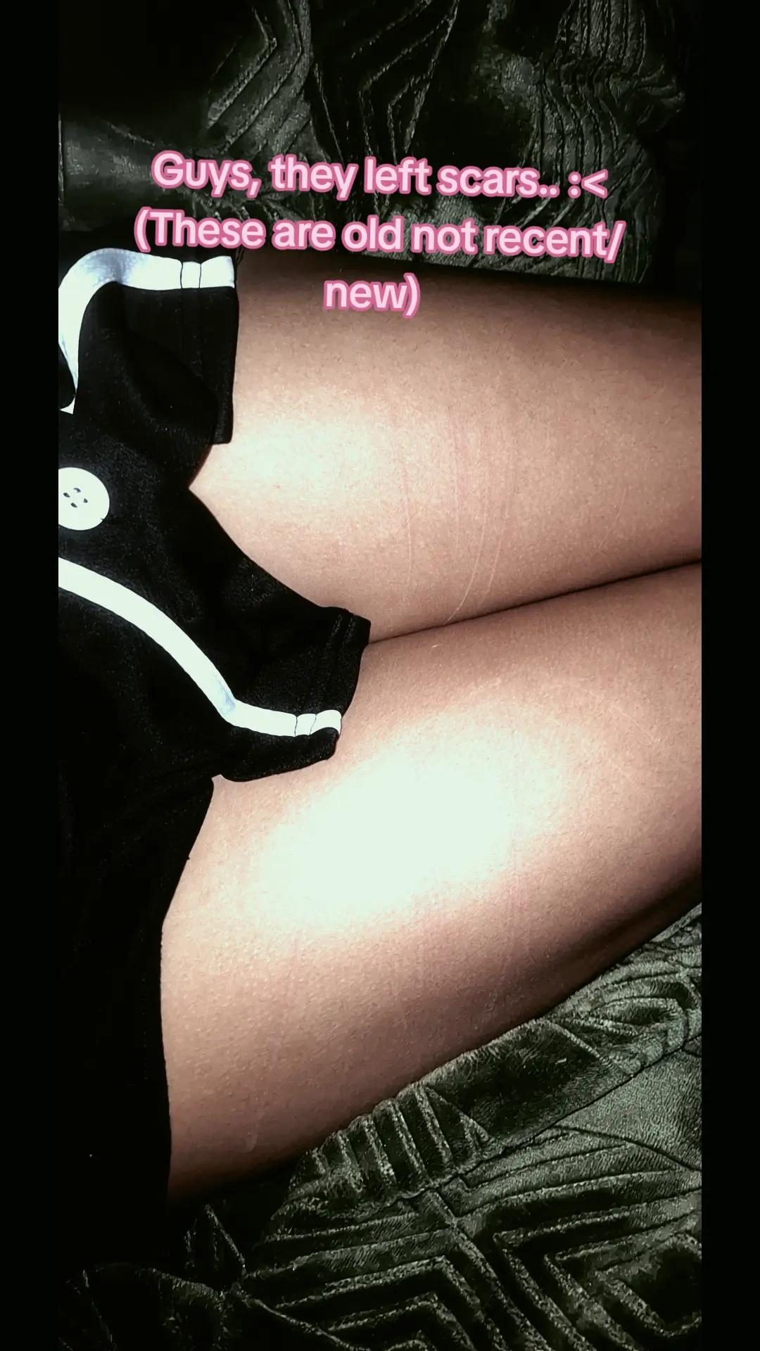 @•`‽Masked★Femboy‽`•