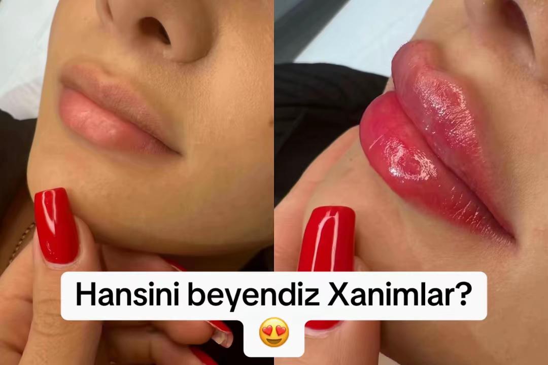 @Kosmetoloq_Gülü_Rajab