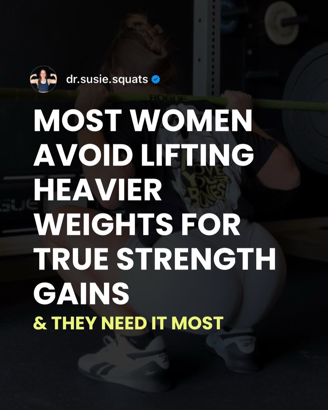 @Susie Spirlock, PT, DPT