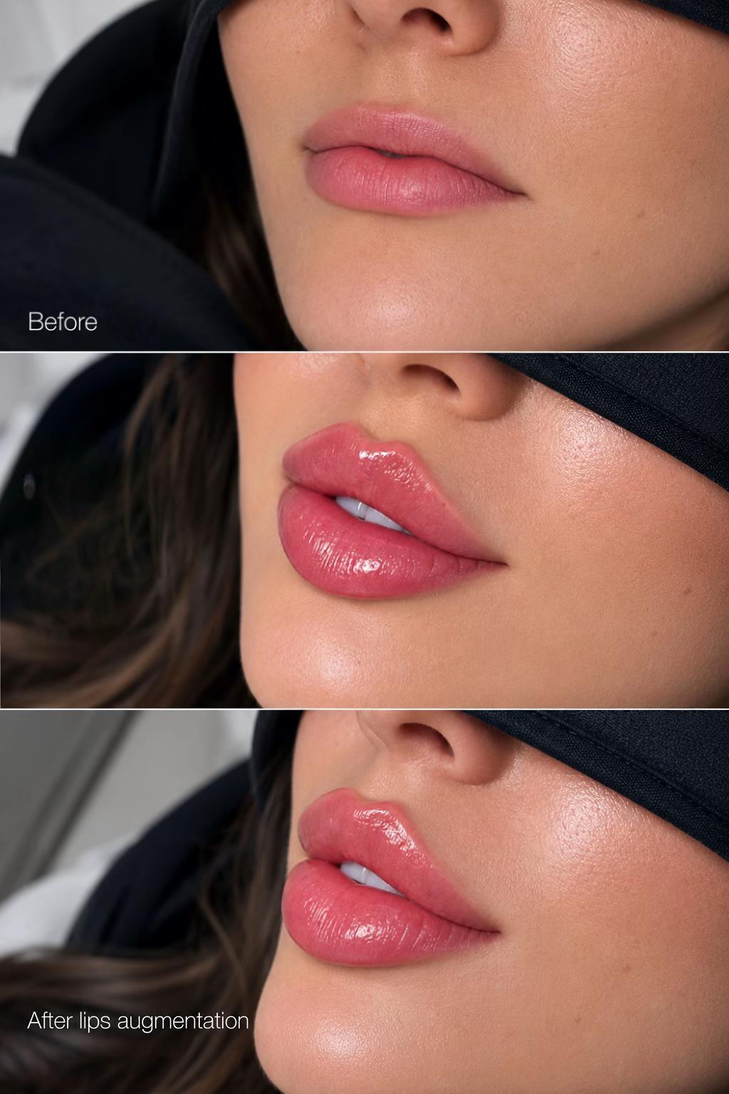 @Lips_for_kiss