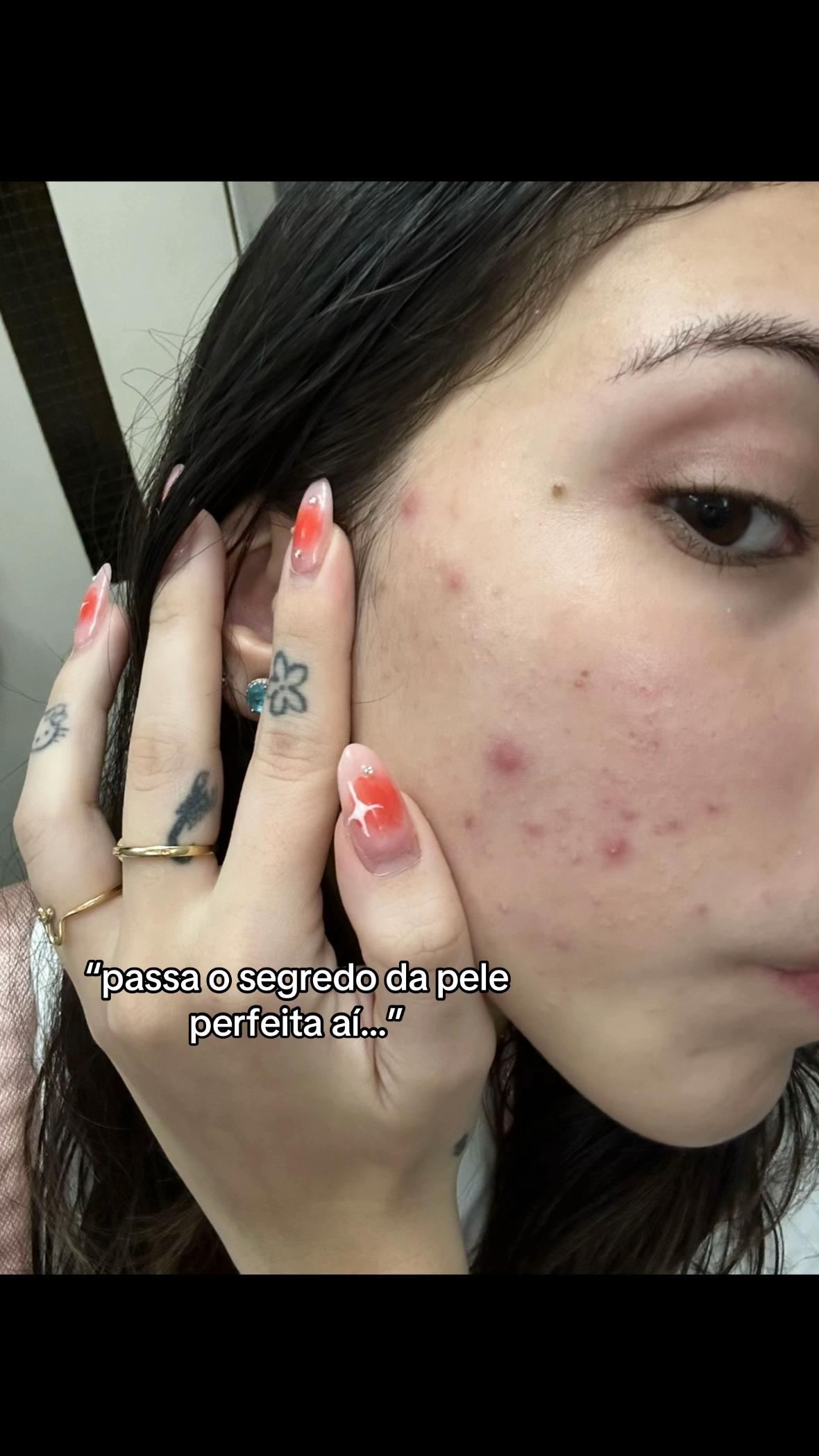 @lau