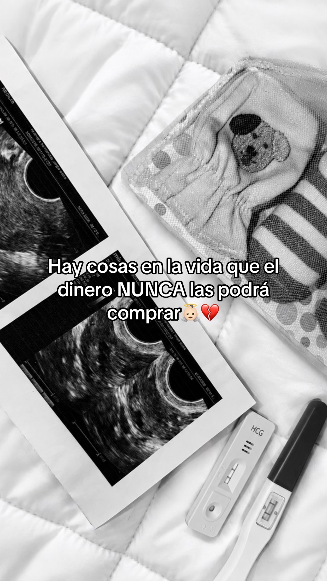 @Angie