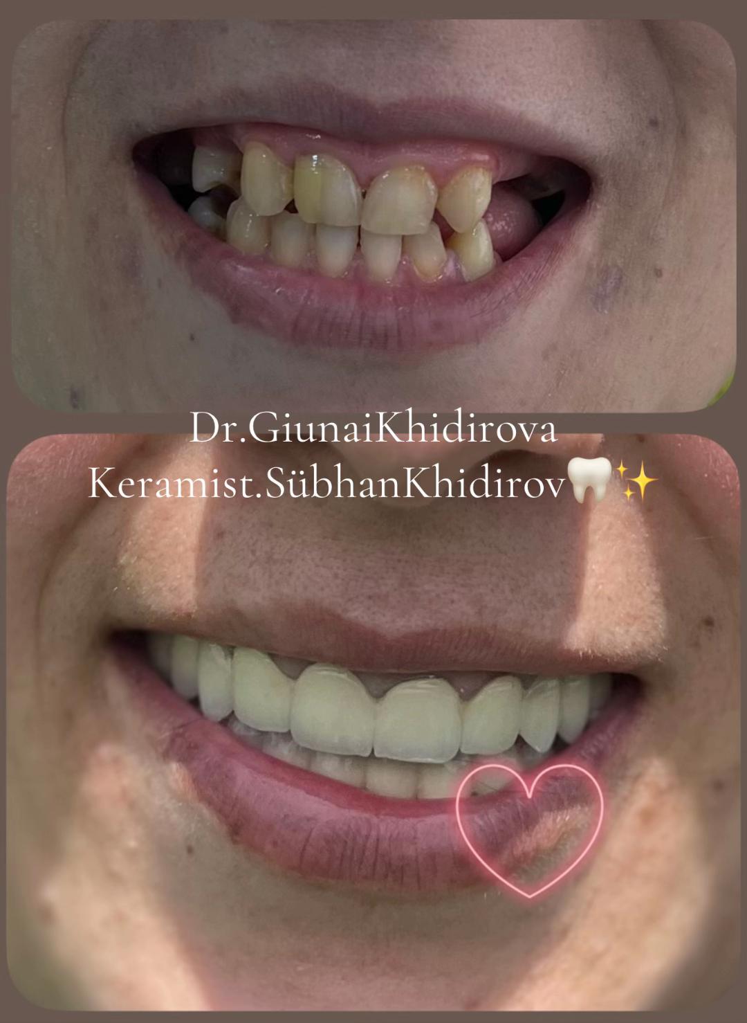 @Dr.Гюнай