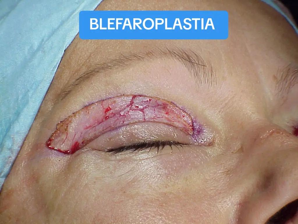 @Belanovacirugiaplastica