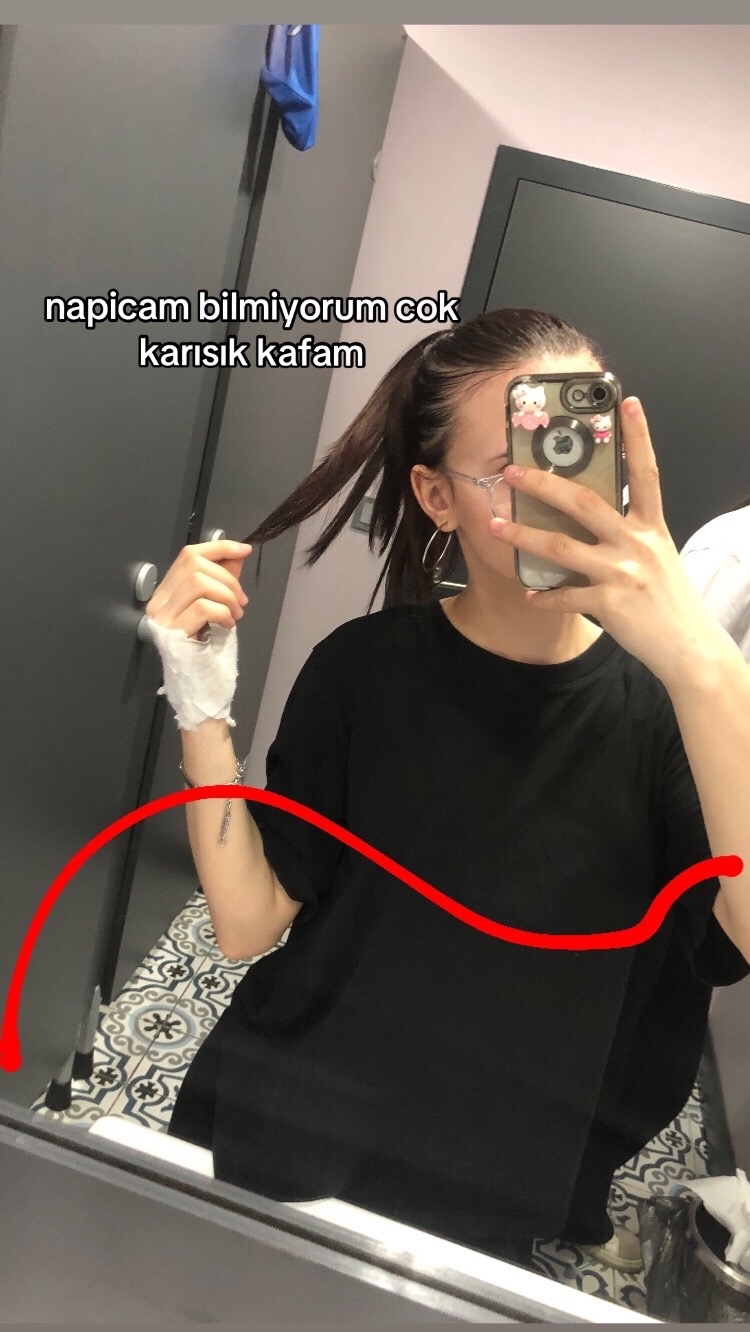 @elif