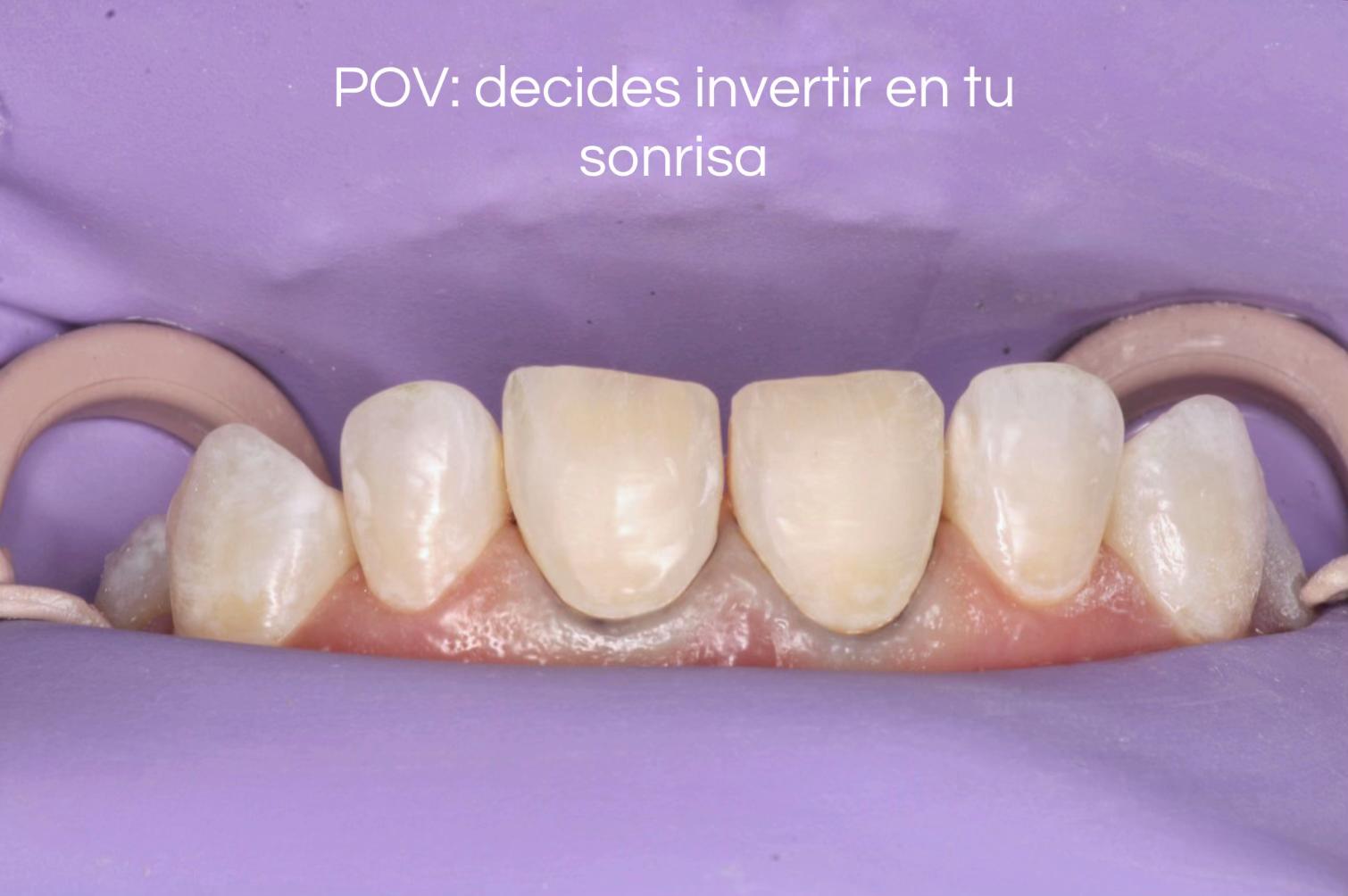 @Cava Clínica Dental 🦷