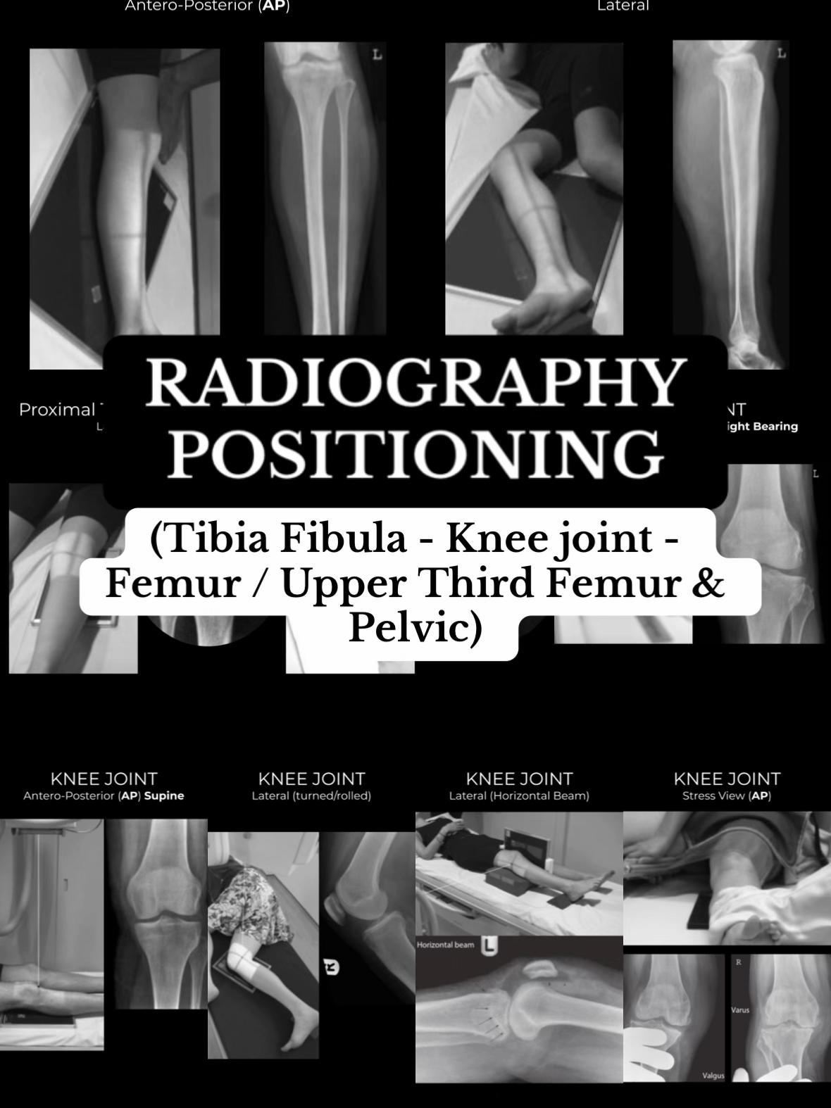 @Sobat Radiology