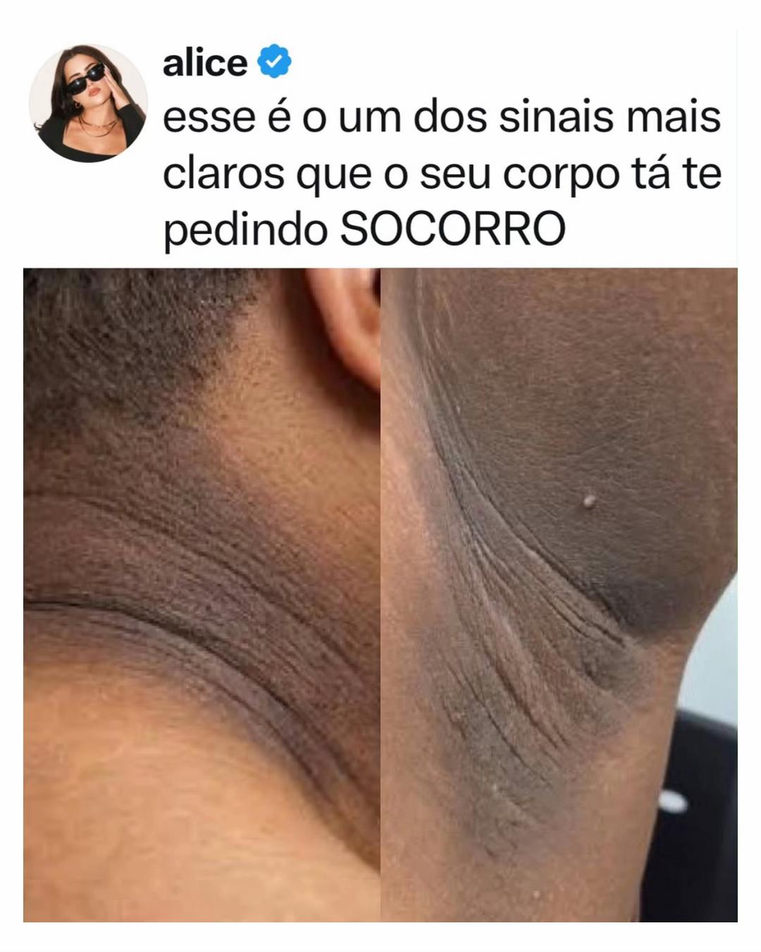 @Alfinetei