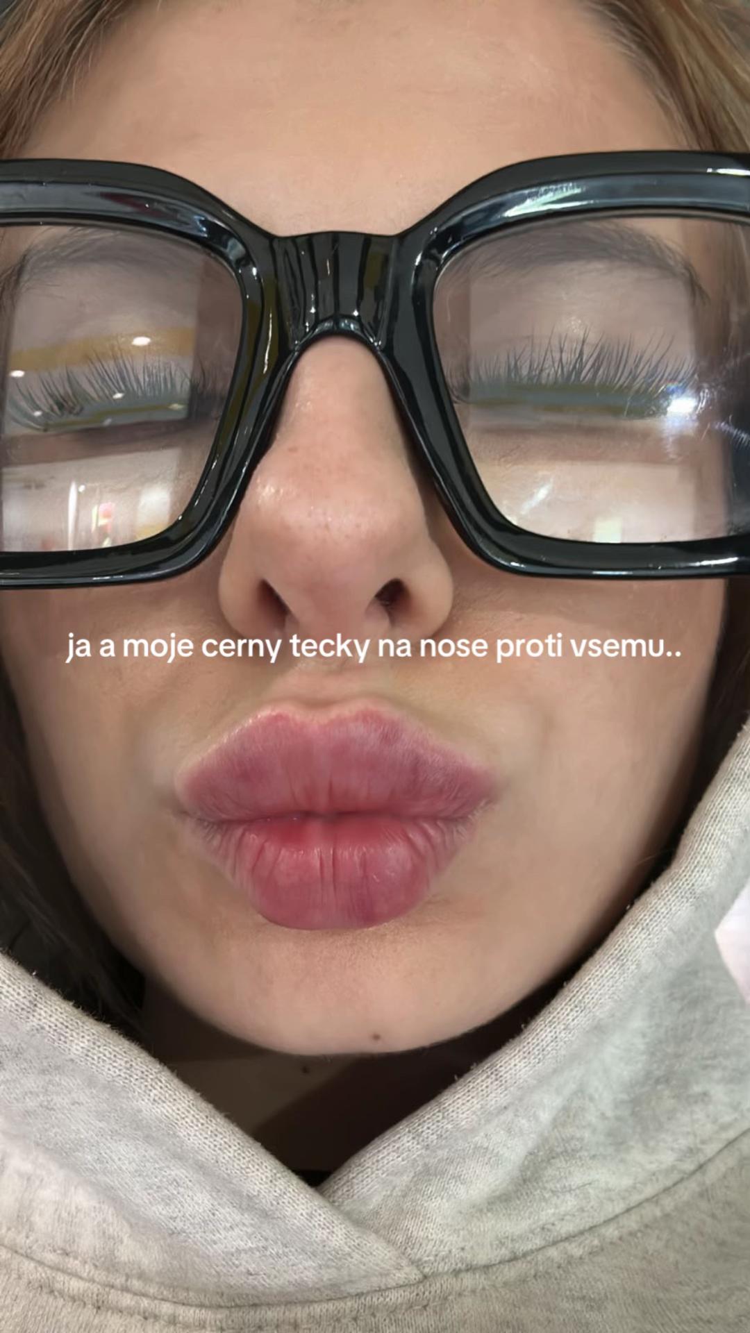 @kylie