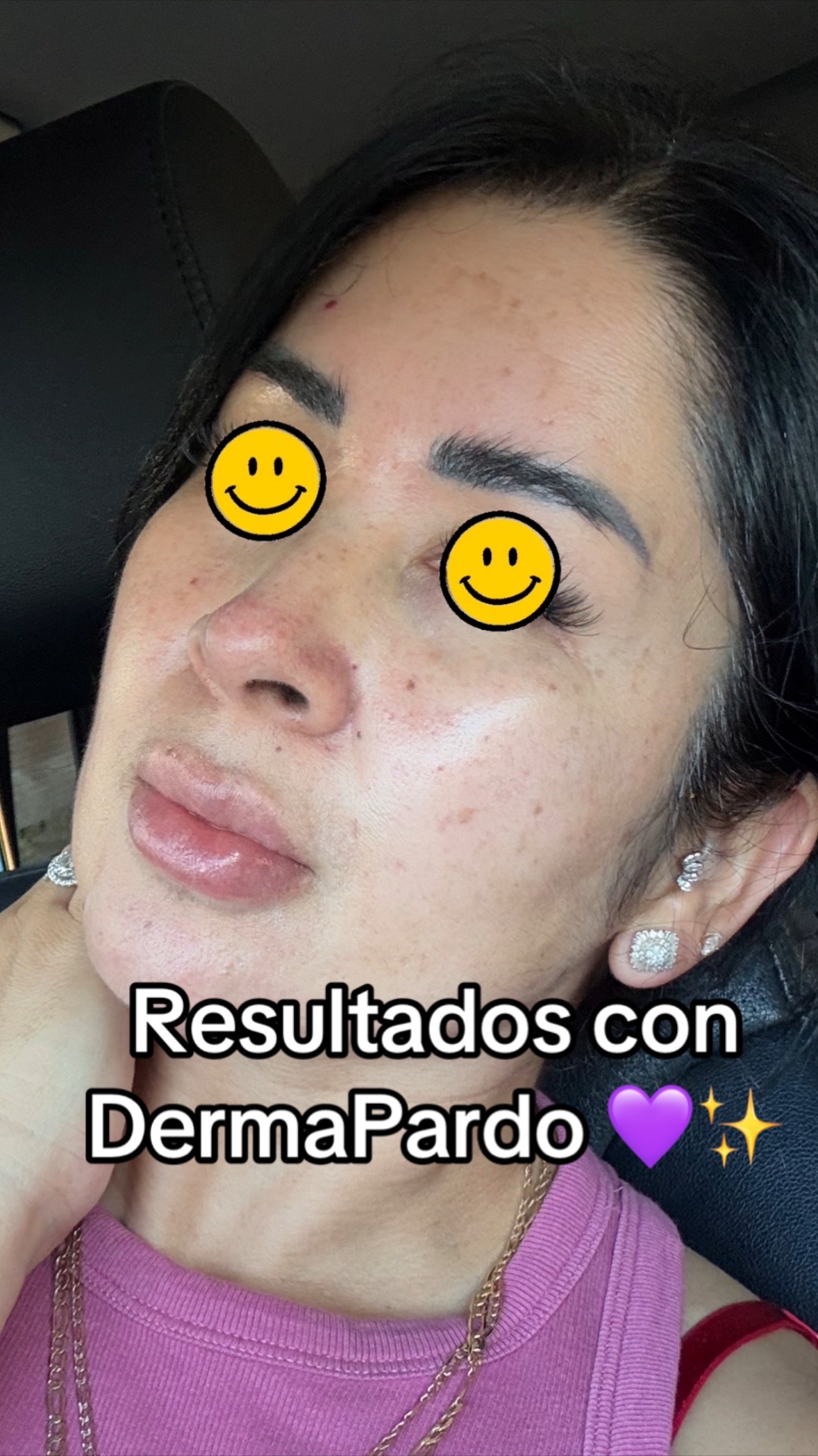 @✨Derma Pardo 💜