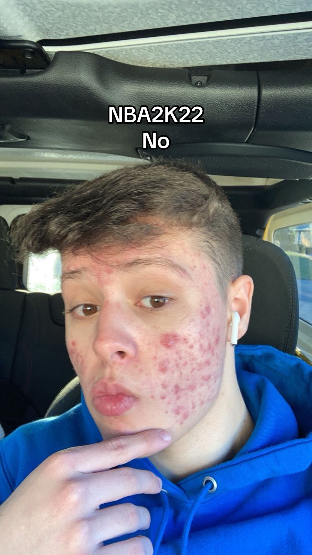 @Enzo 2K🤴