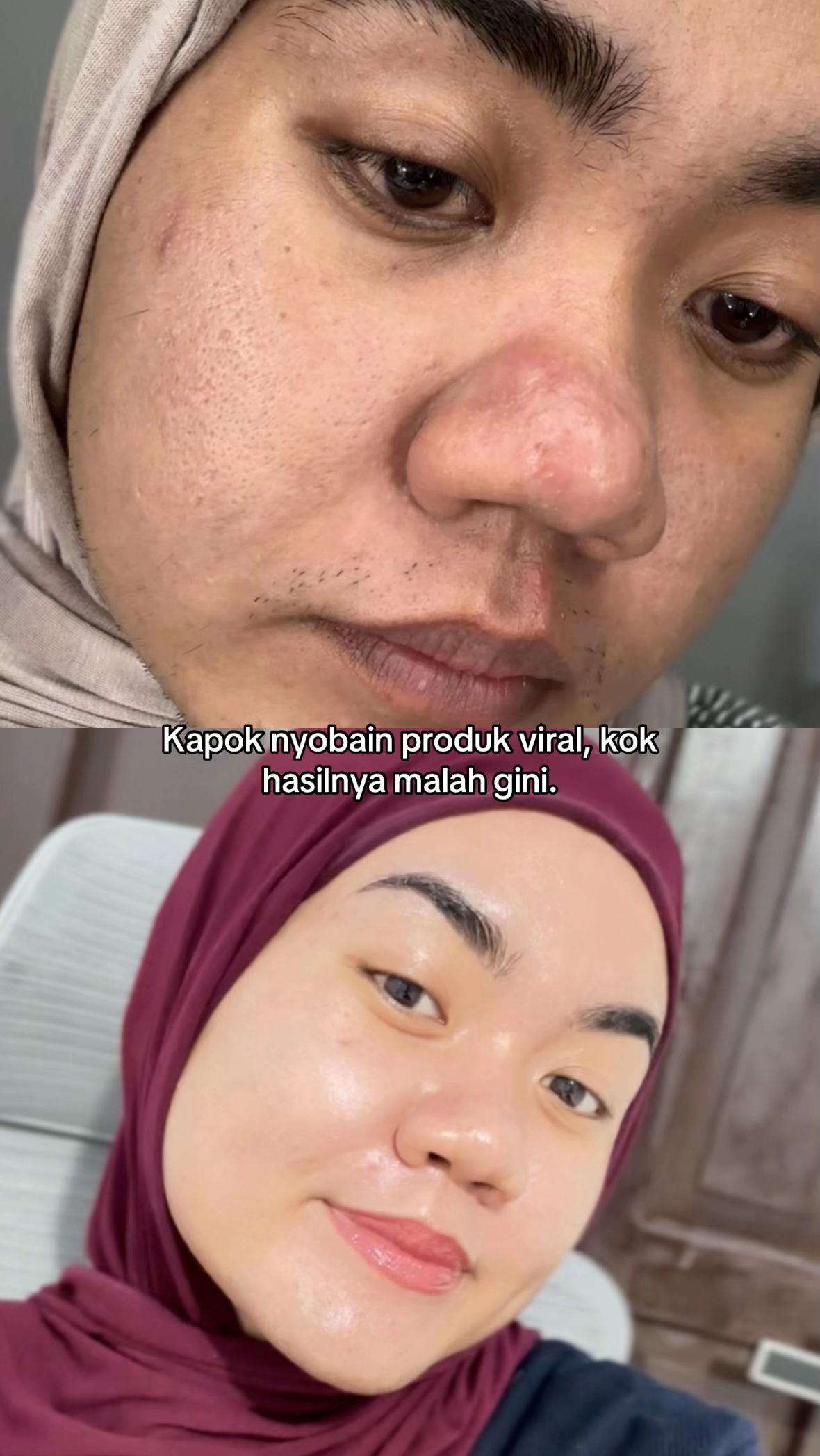 @Mbak Brewok