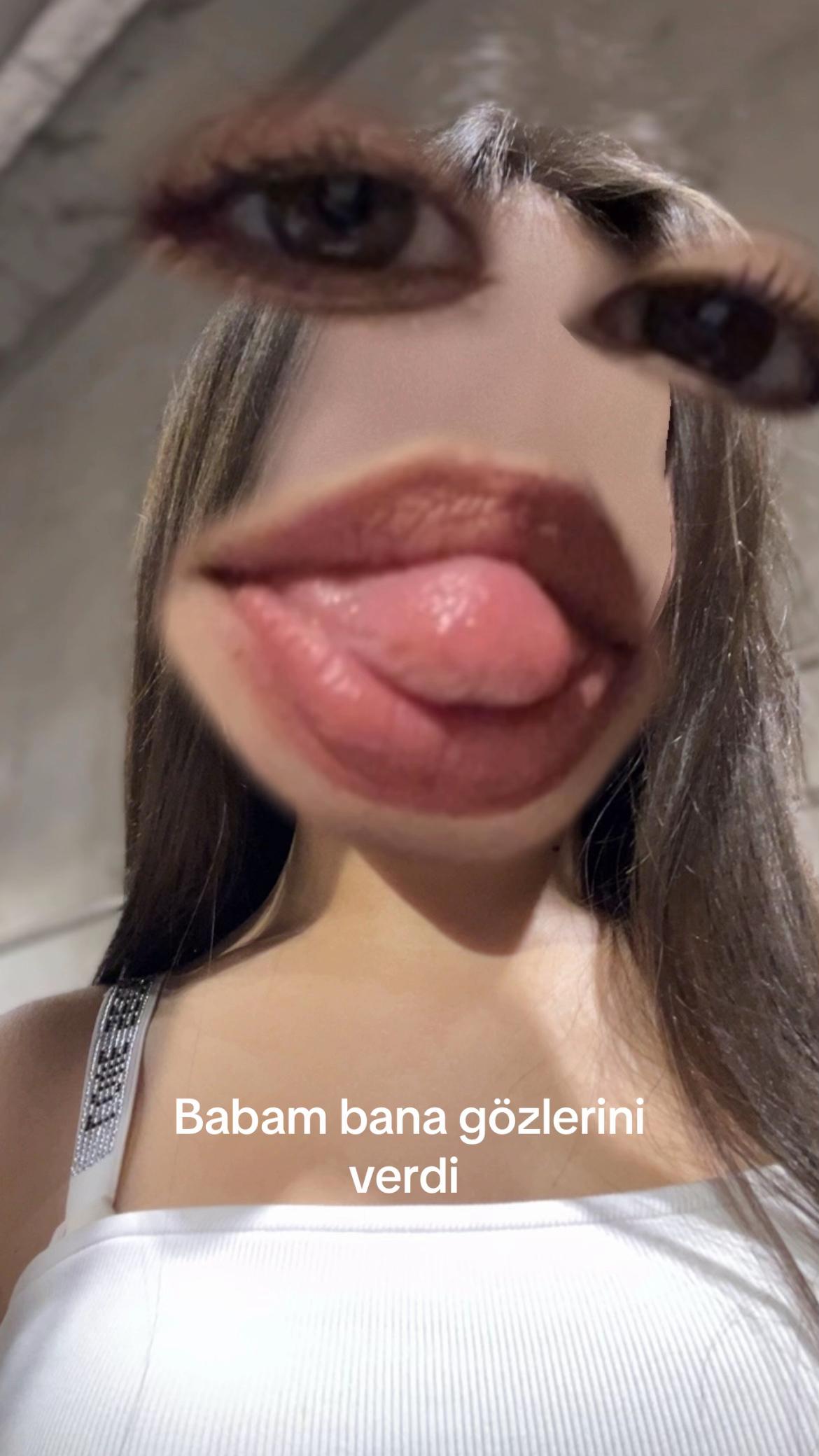 @spastiknunus21