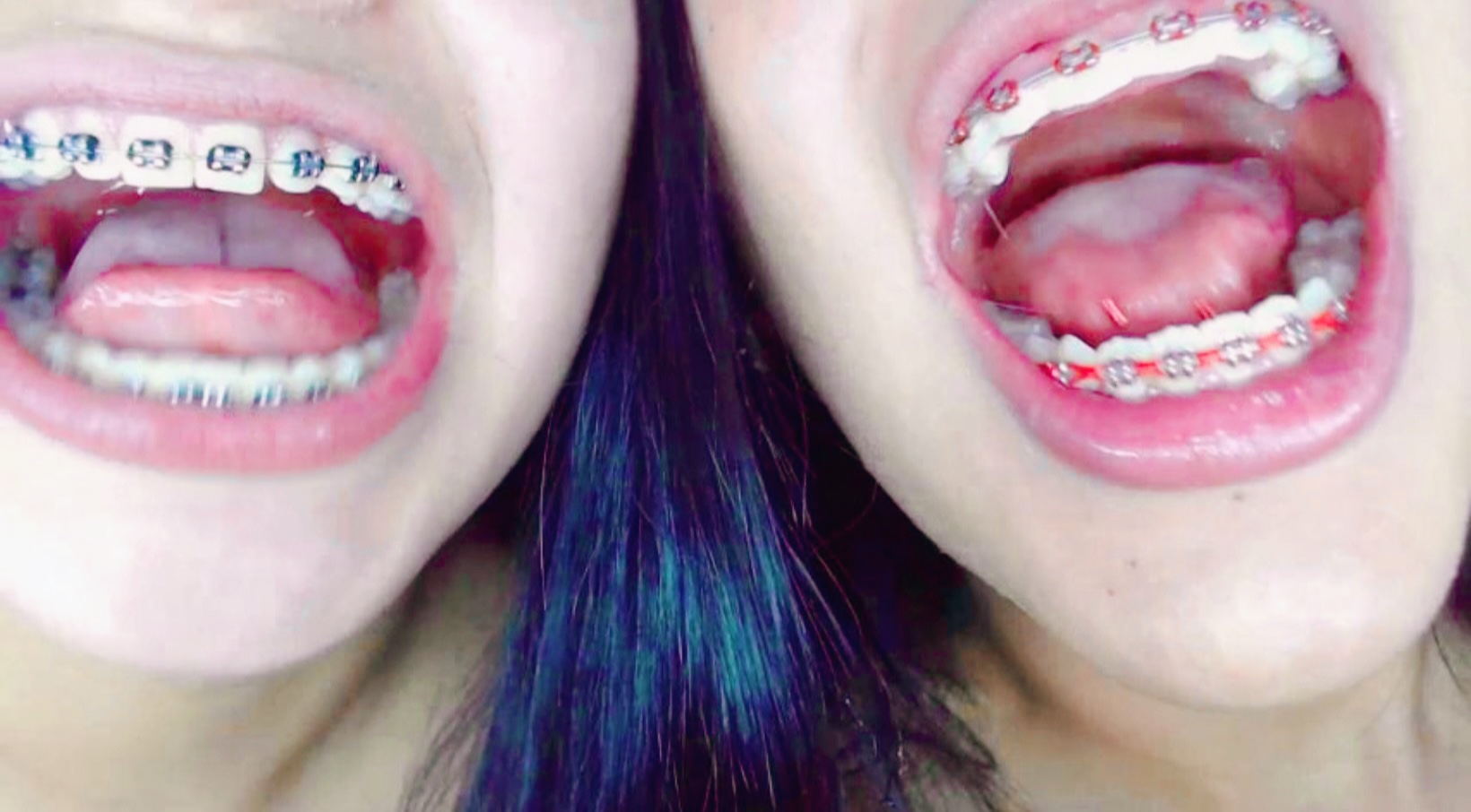 @TeethfairyEvah