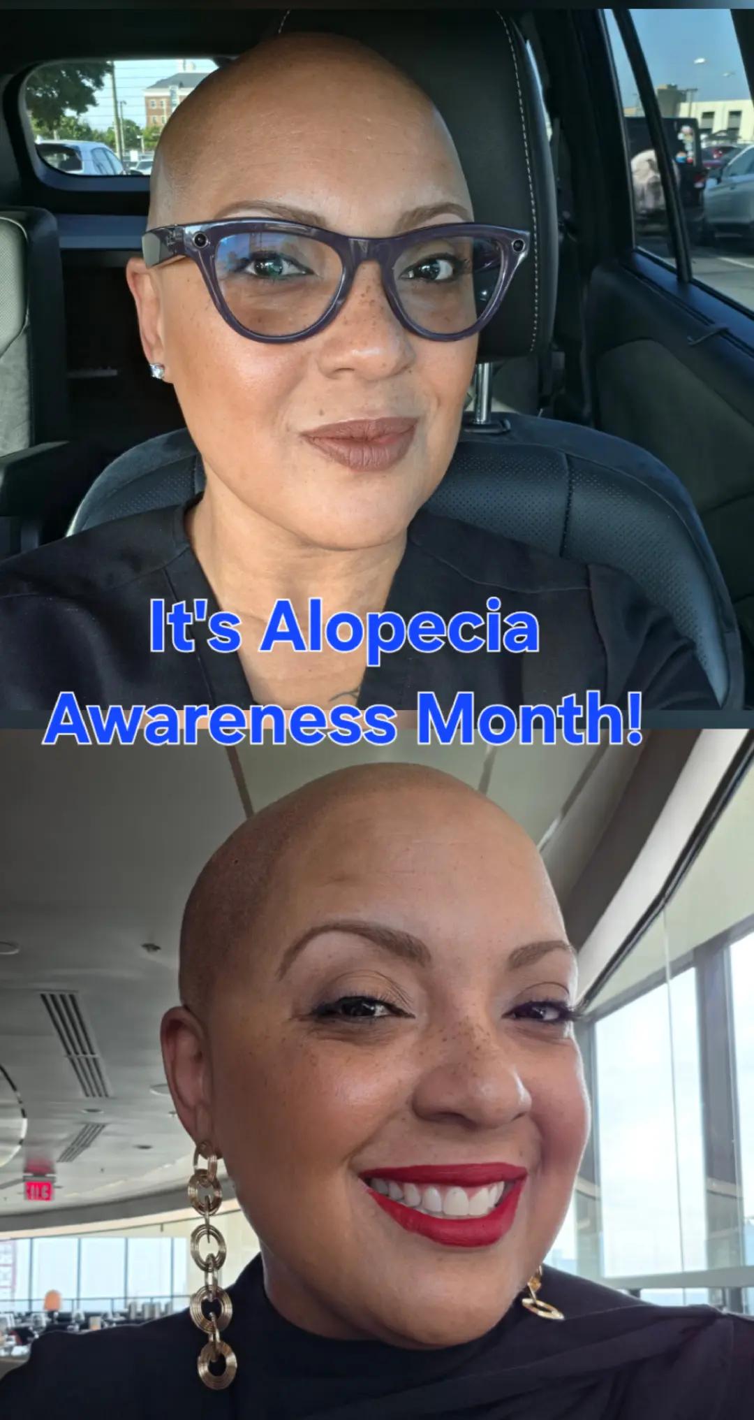 @BaldBeauty2020