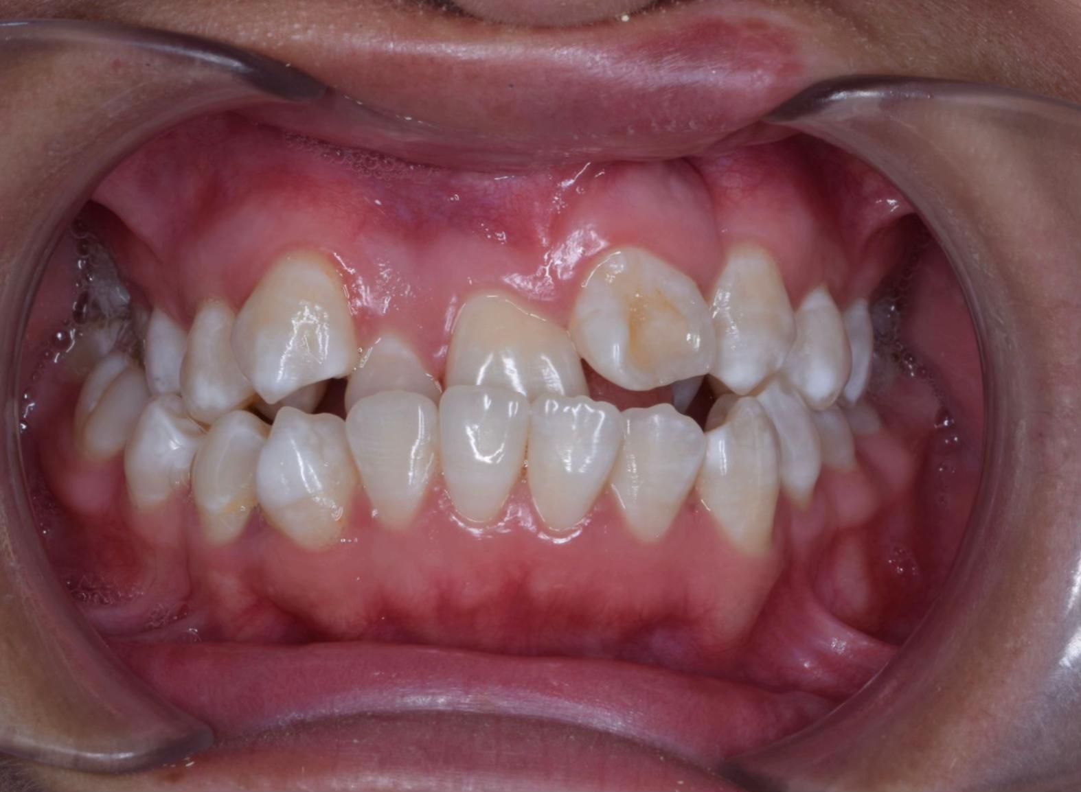 @Dr. Juan Perez | Ortodoncista