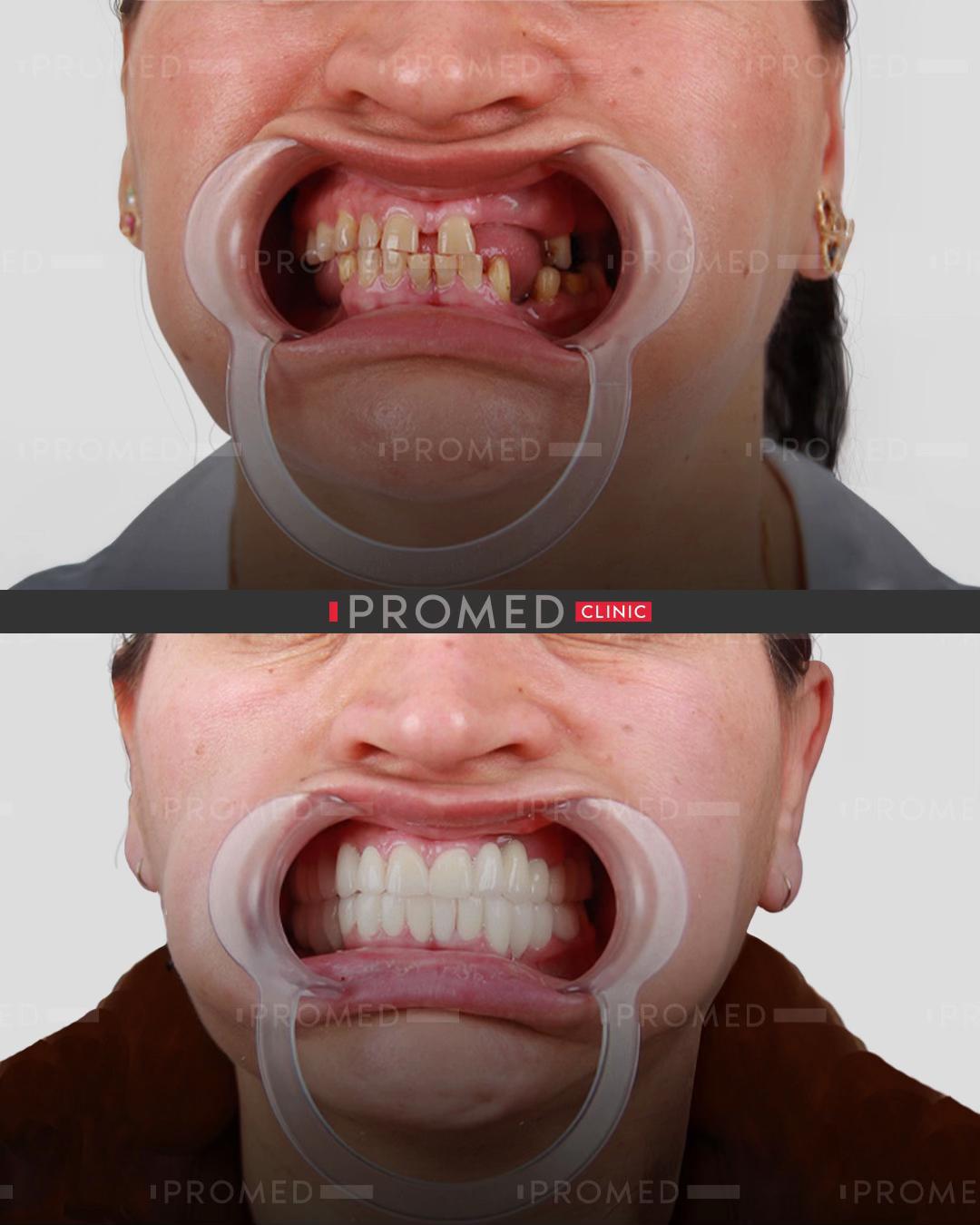 @promeddentalclinic
