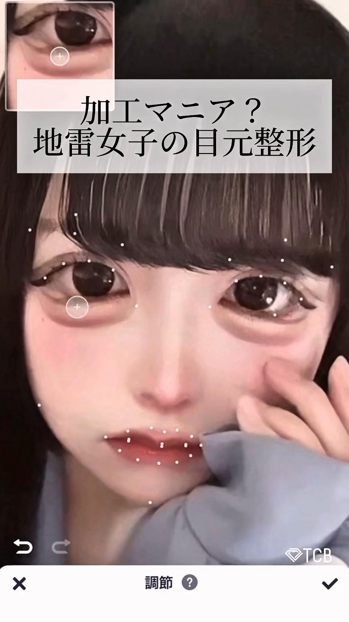 @【二重整形】TCB 新宿東口院ゆいこ先生/東京