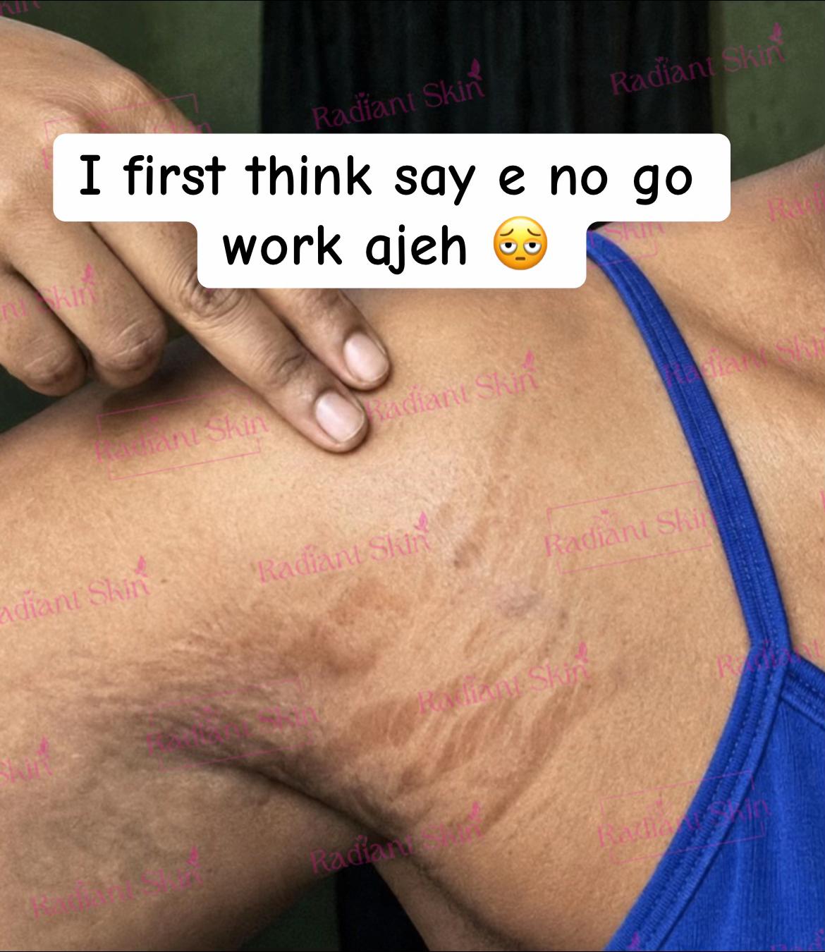 @Radiant skin