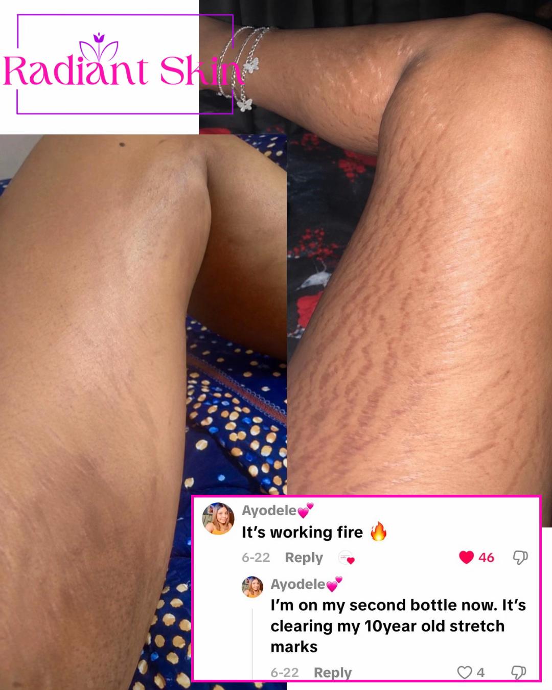 @Radiant skin