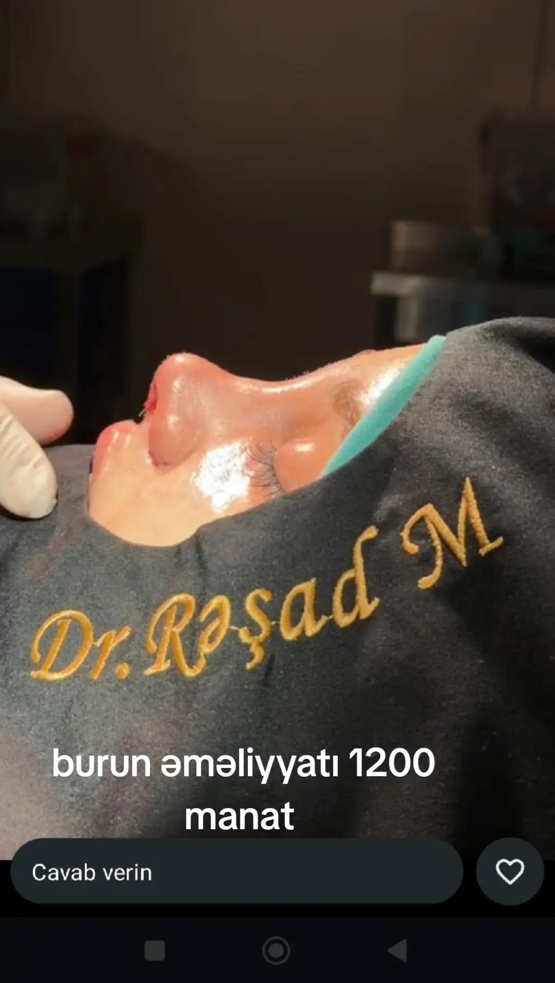 @rinoplastika_lor.dr.resad