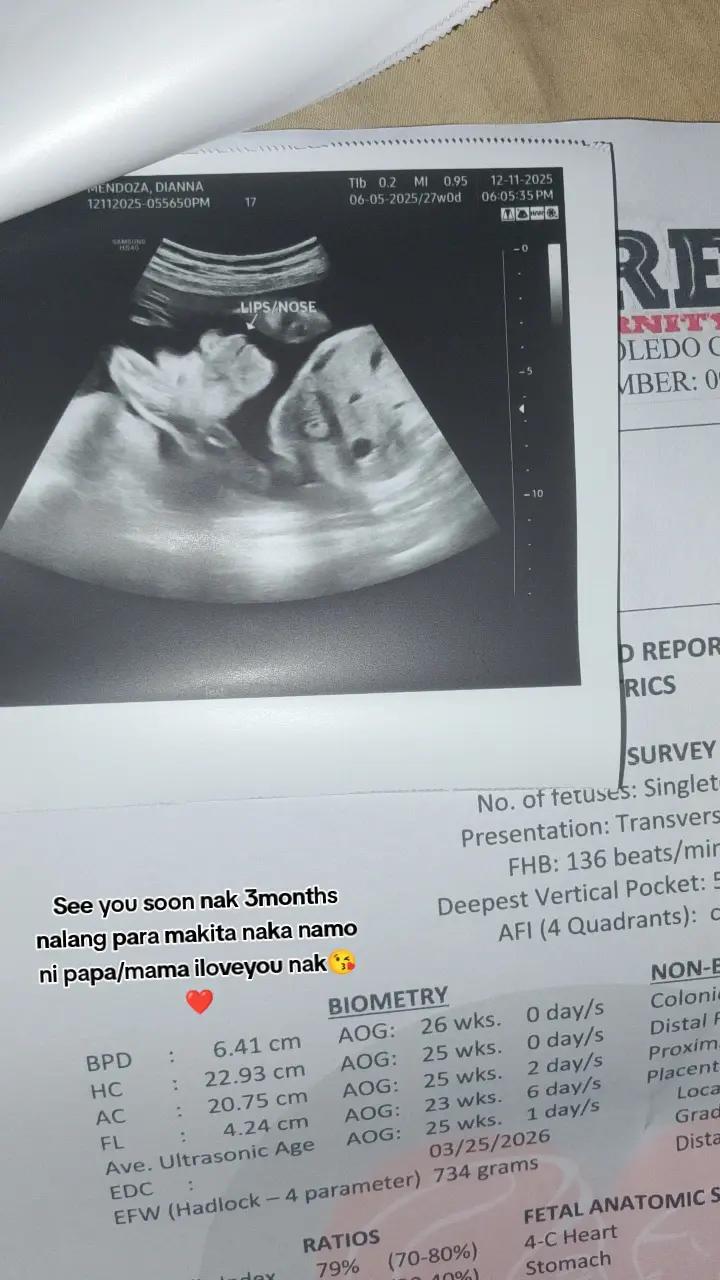 @Itsme_ianne