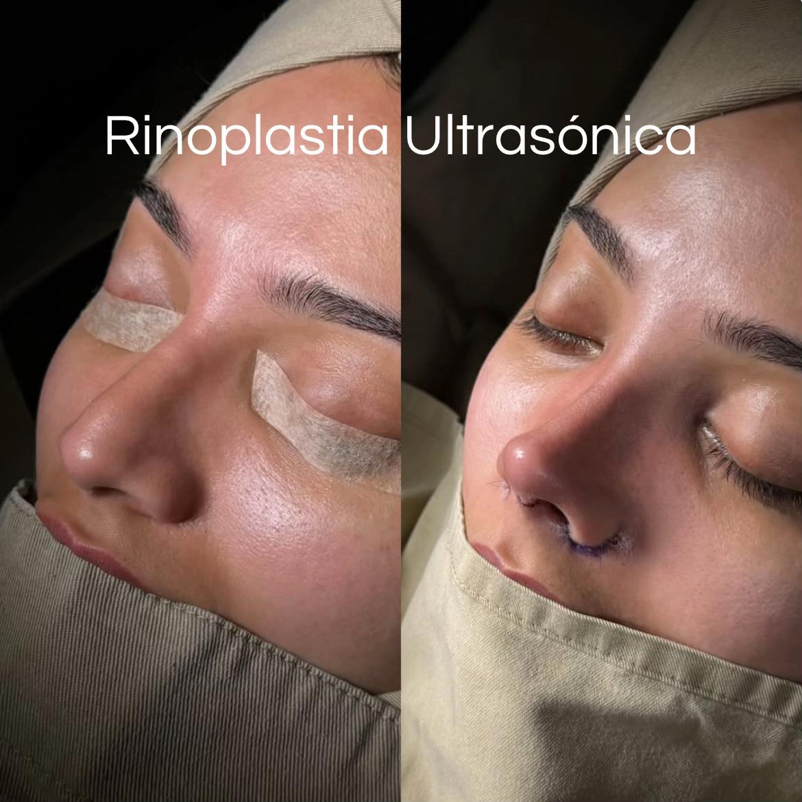 @Eliana Garc&eacute;s Plastic Surgery