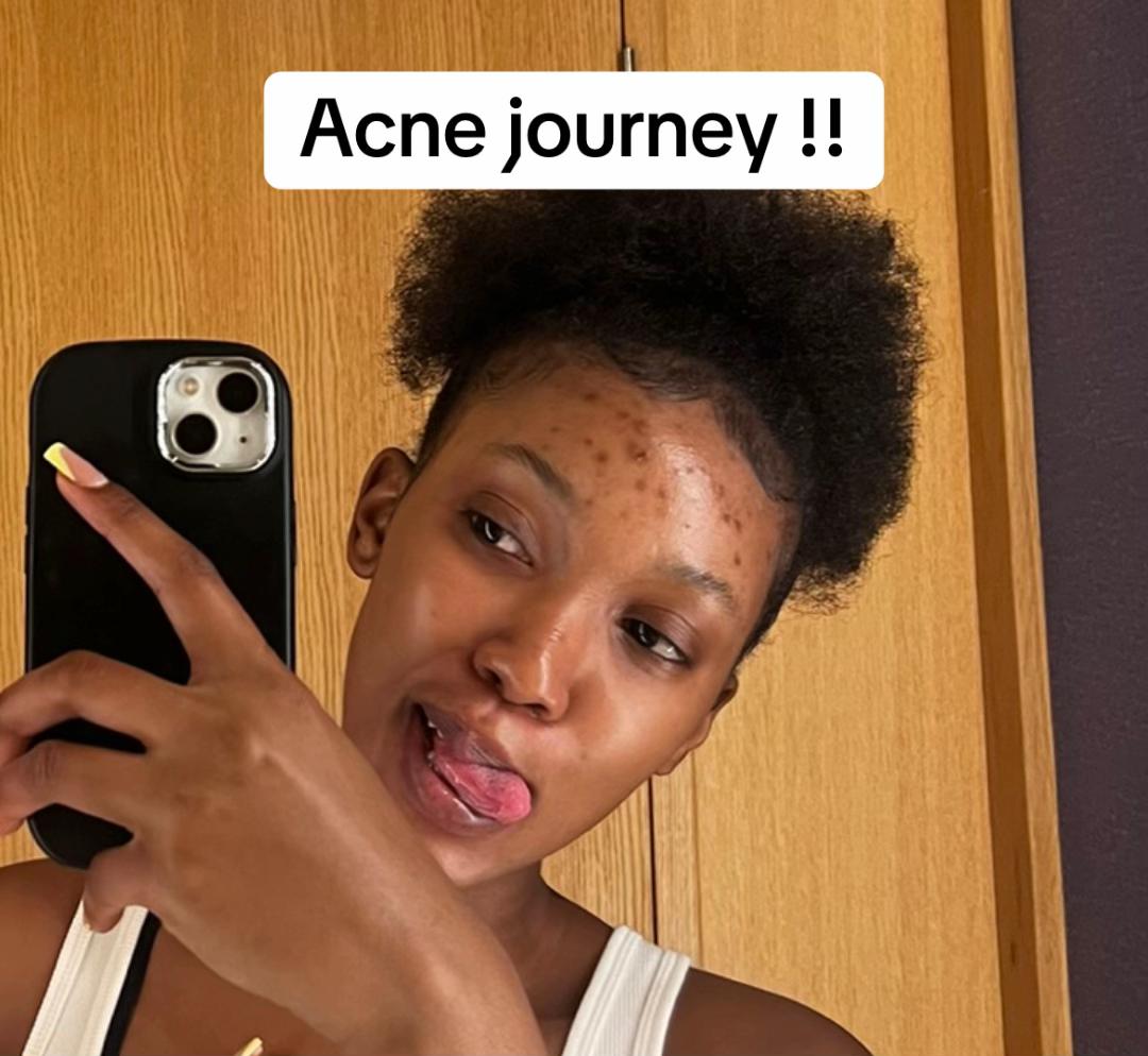 @A xhosa hun❤️