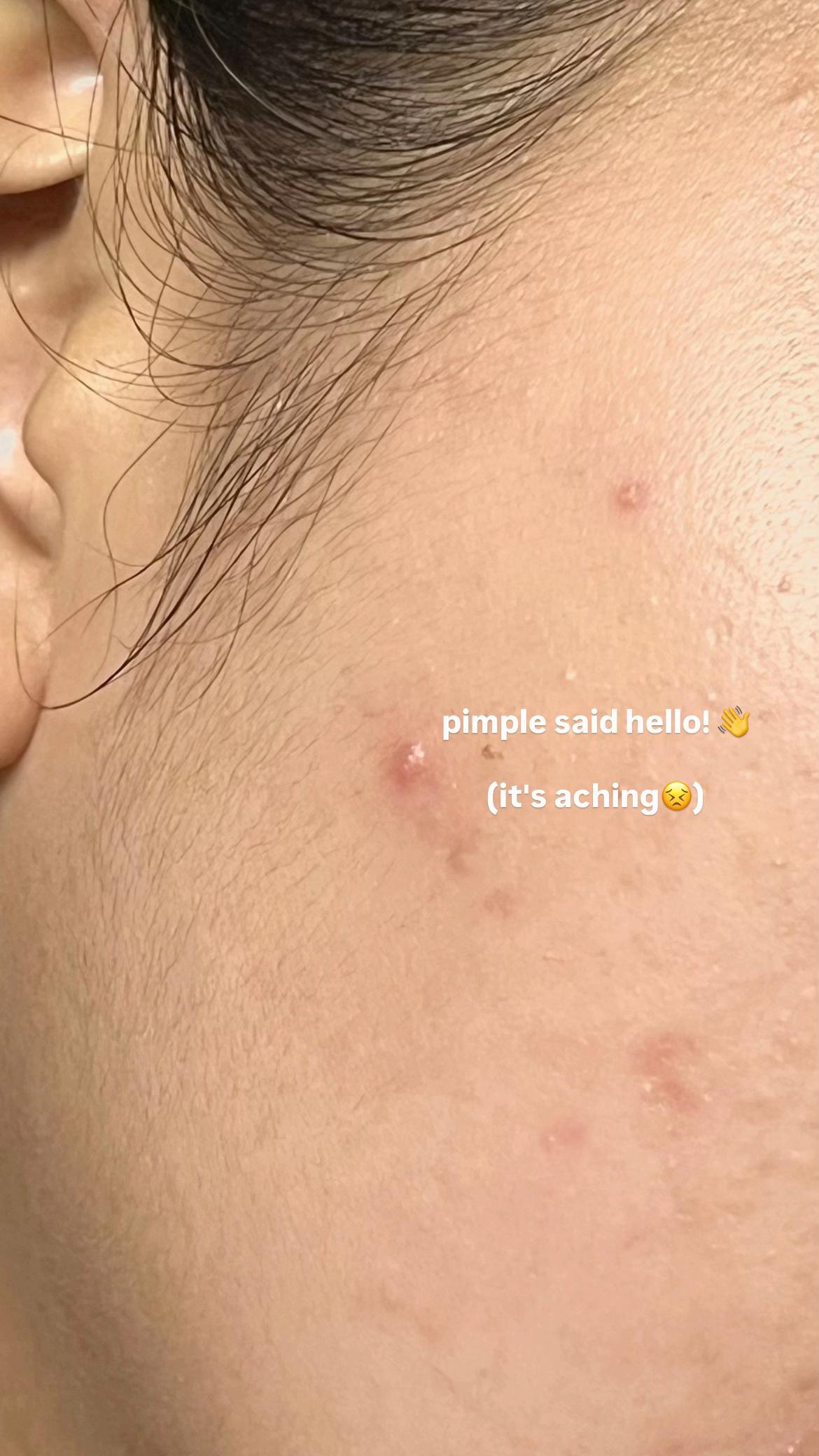 @neilaudrey_ on ig