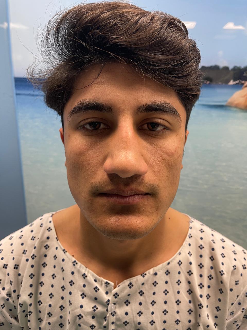 @Dr Ihsan Hair Transplant