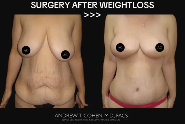 @Cohen MD Plastic Surgery