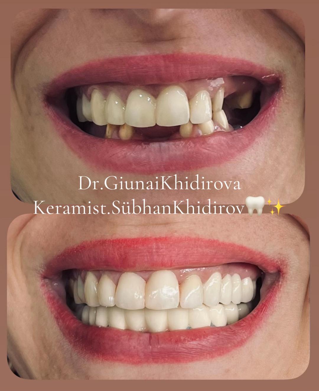 @Dr.Гюнай