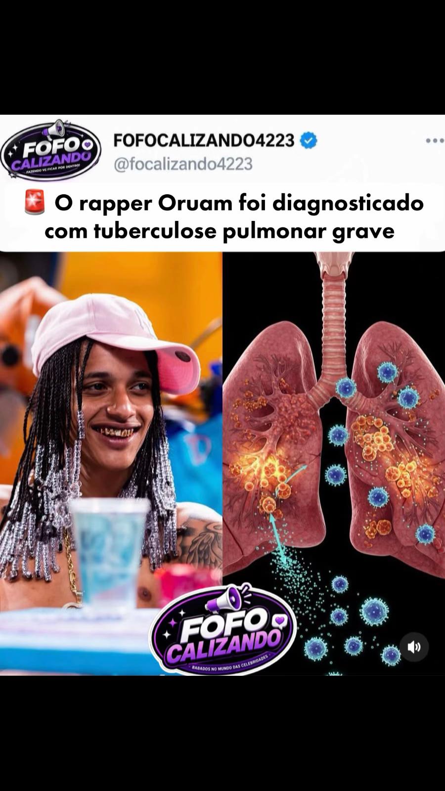 @FOFOCALIZANDO