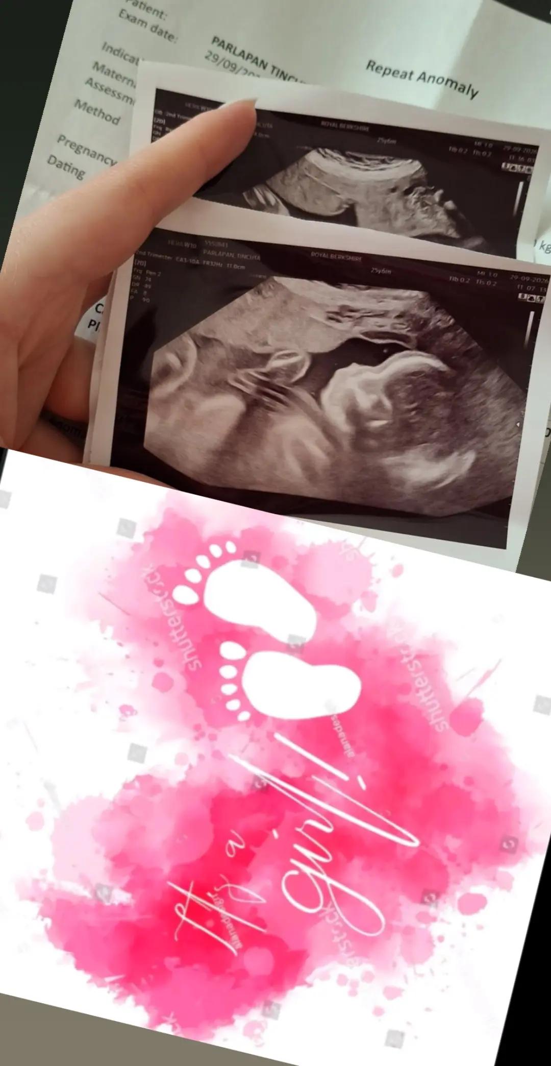@Tincuta Parlapan
