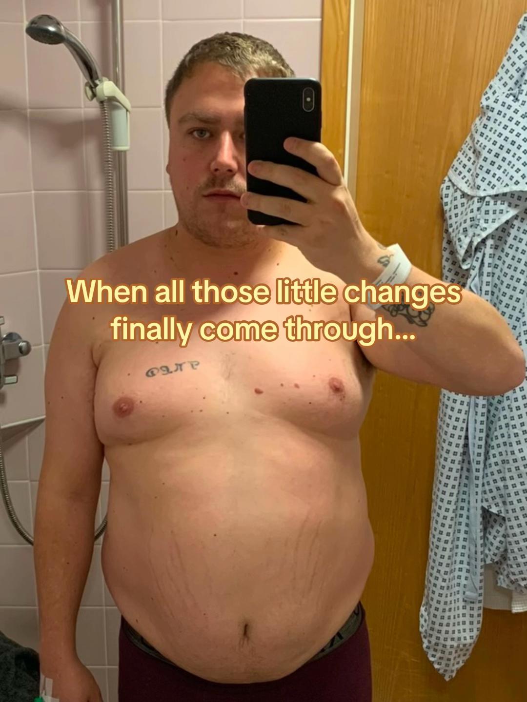 @KD | Life After Weight Loss