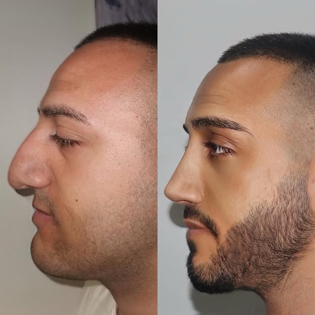 @Xue Skin & Contour