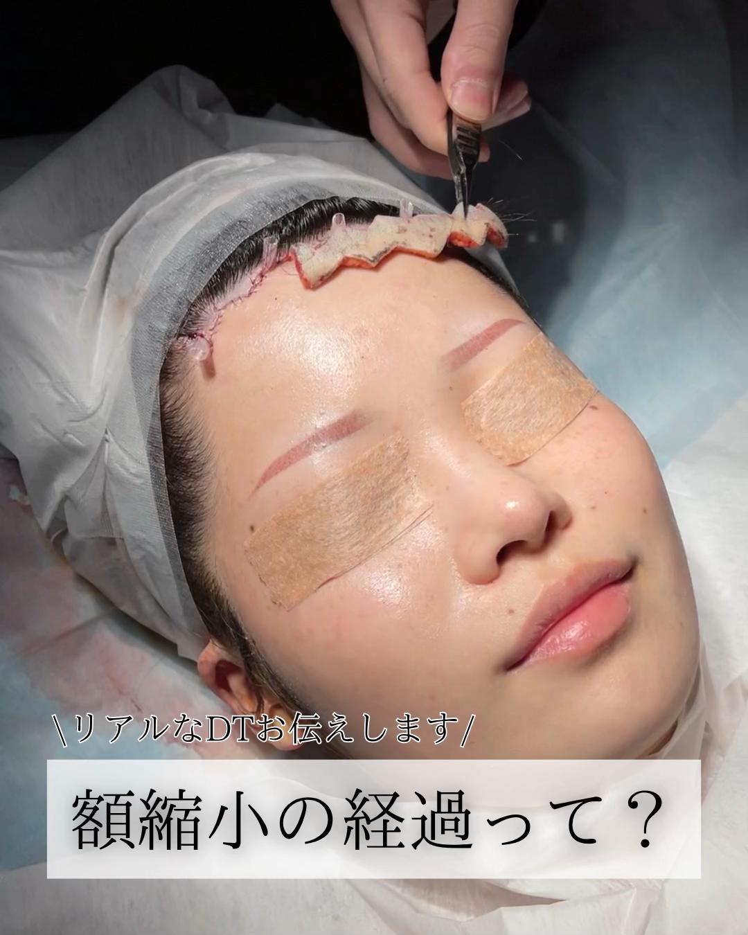 @鼻整形R Beauty CLINIC 副院長👨&zwj;⚕️吉田慧