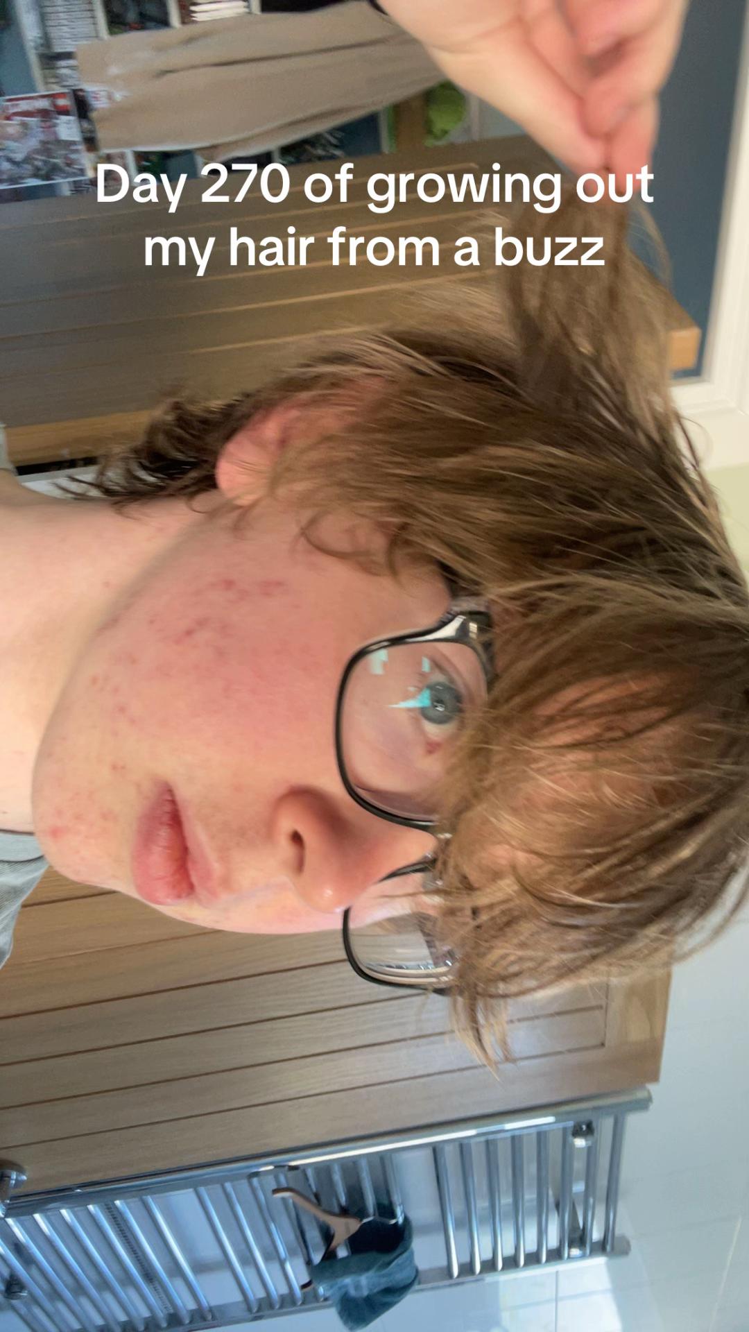 @realharryhair