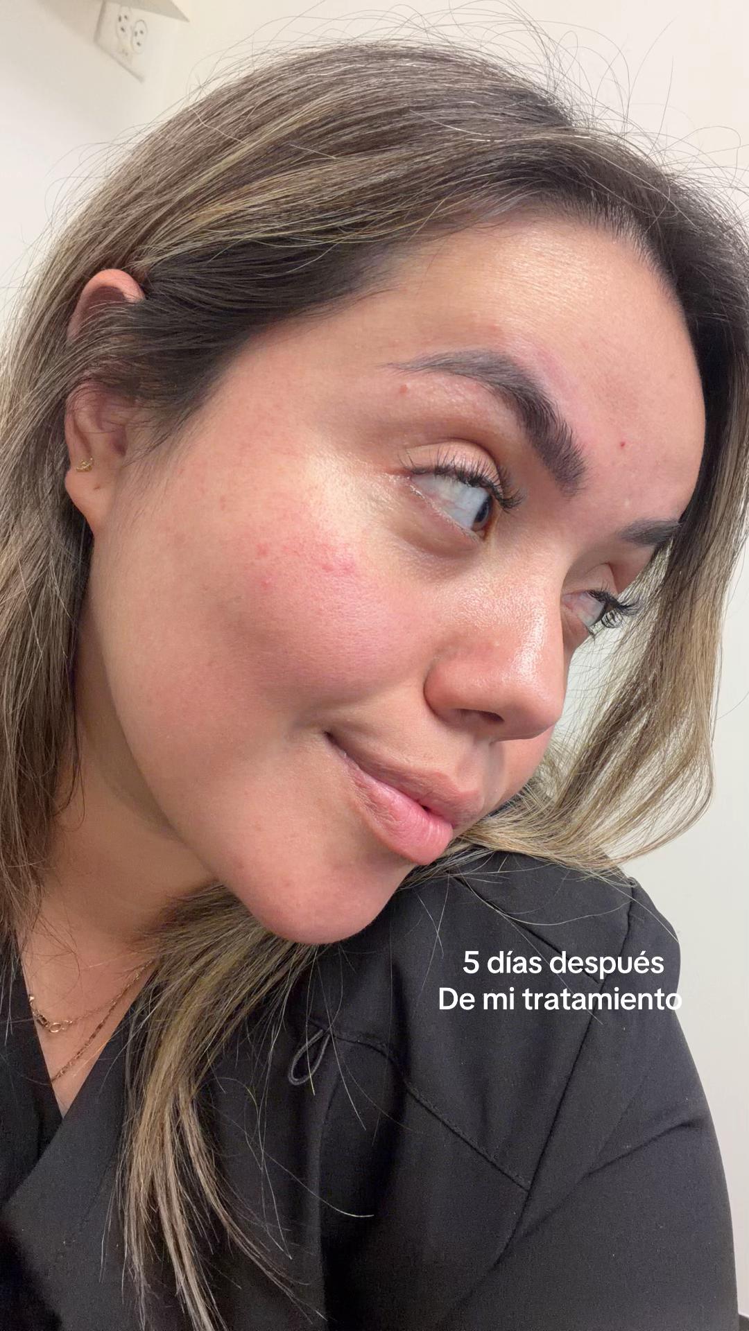 @Elvia Mcabello