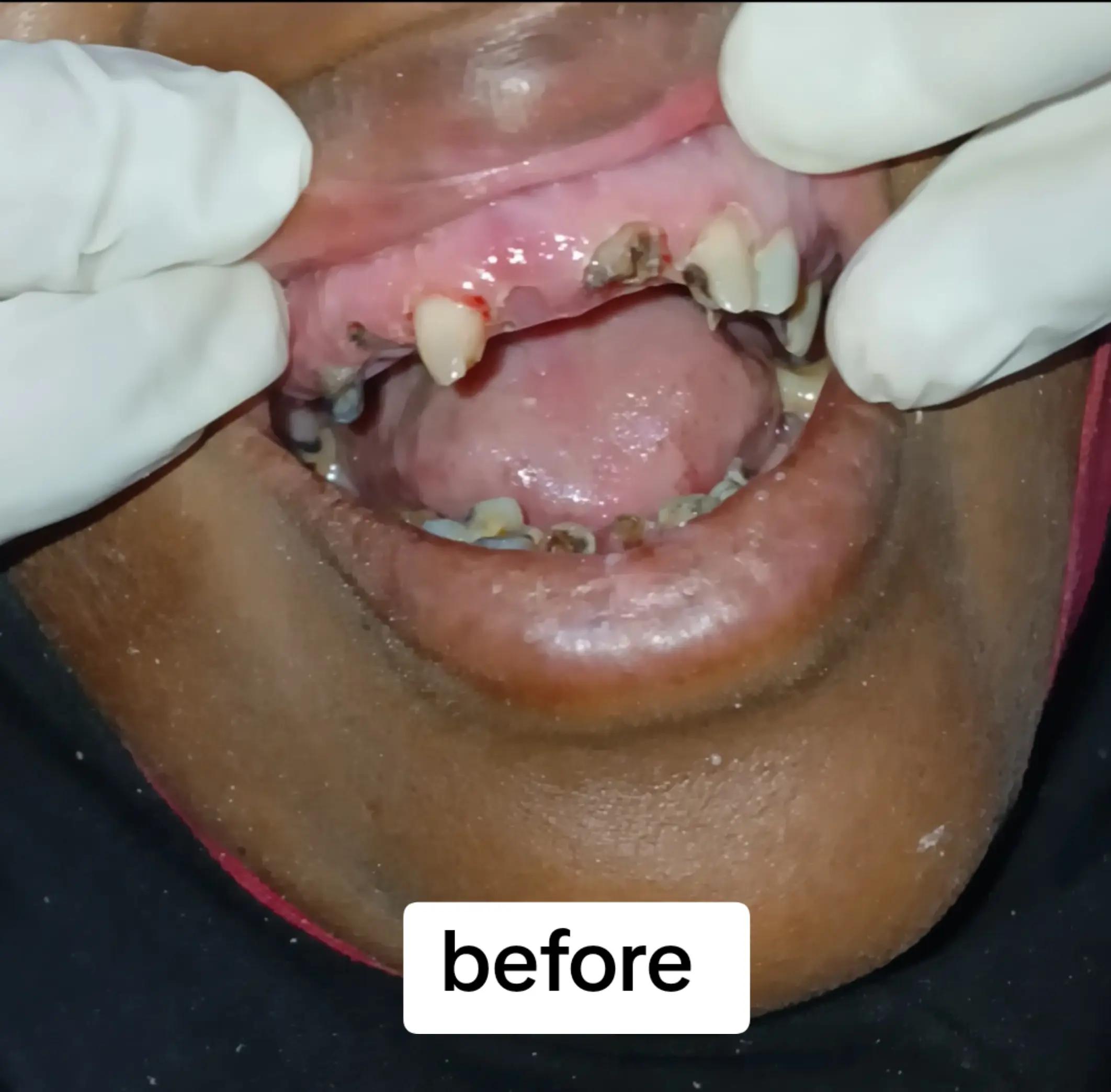 @Dr.Naasir🦷🩵🩺