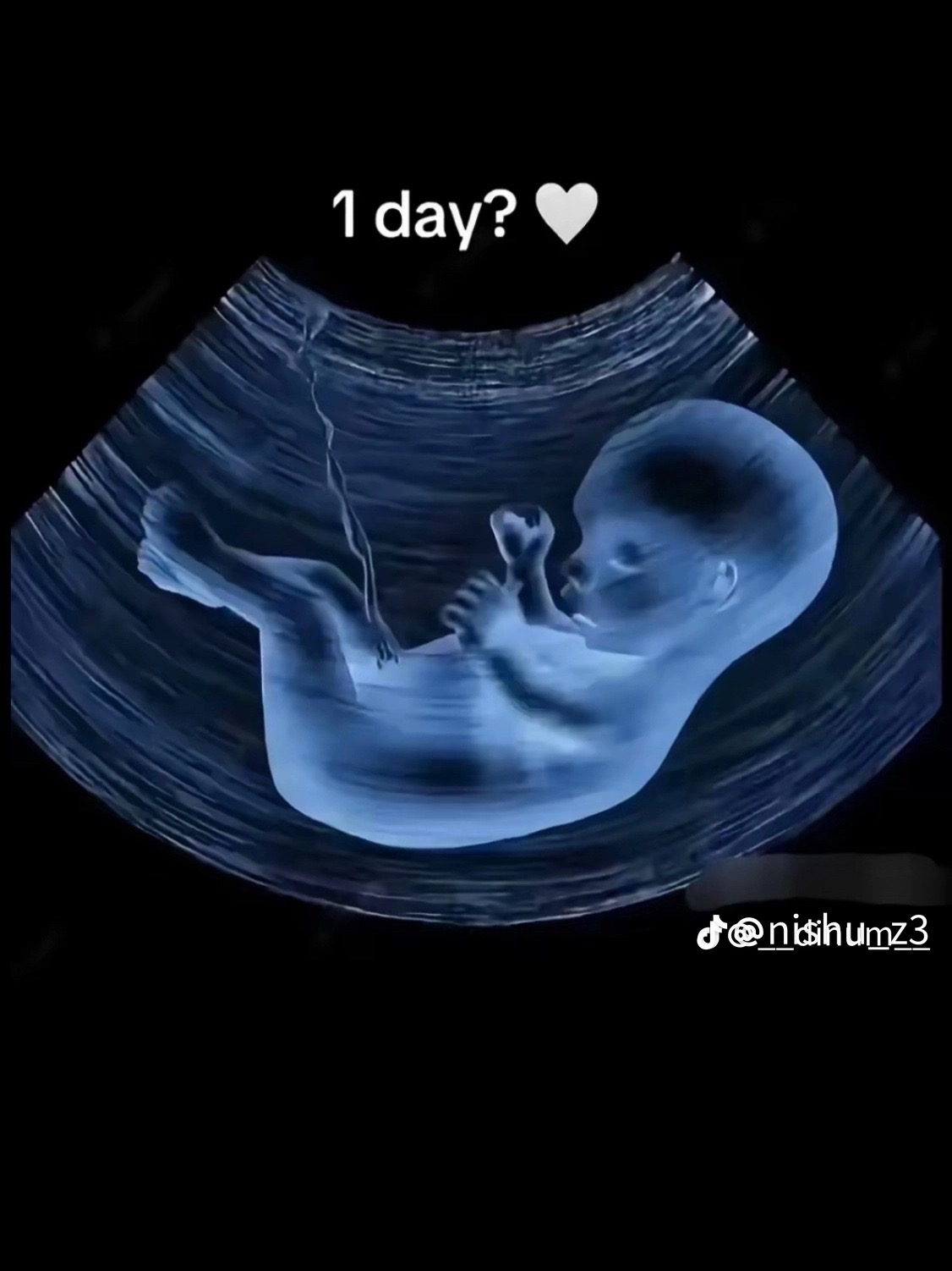 @anubbh_xx