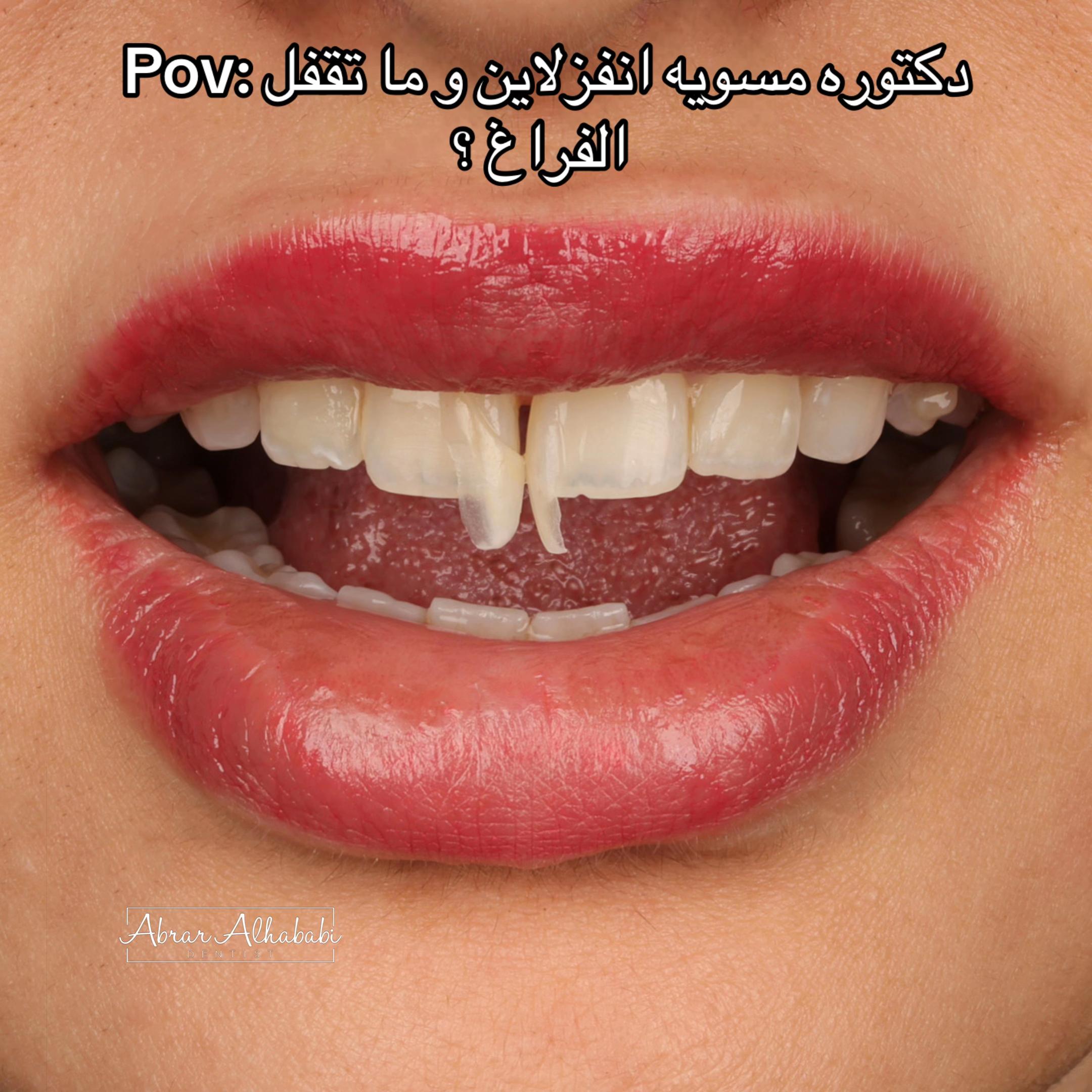 @Dr. Abrar Alhababi