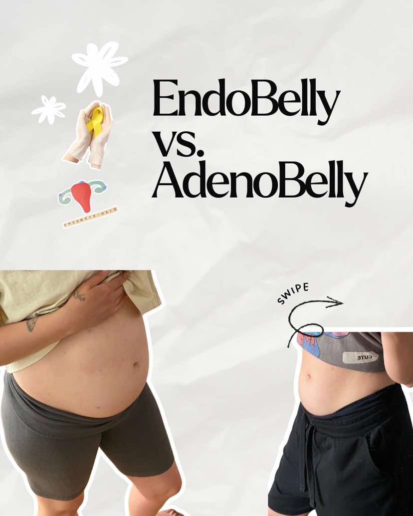 @EndoMona🎗️