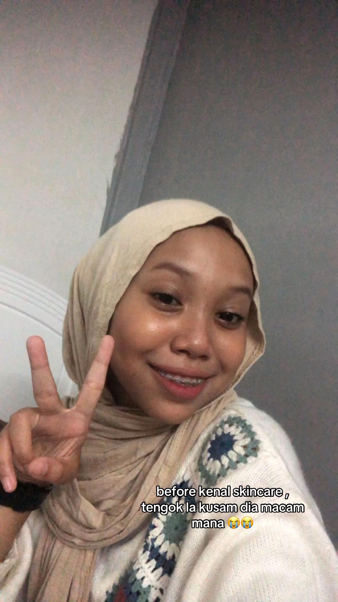 @peaa ๐ค