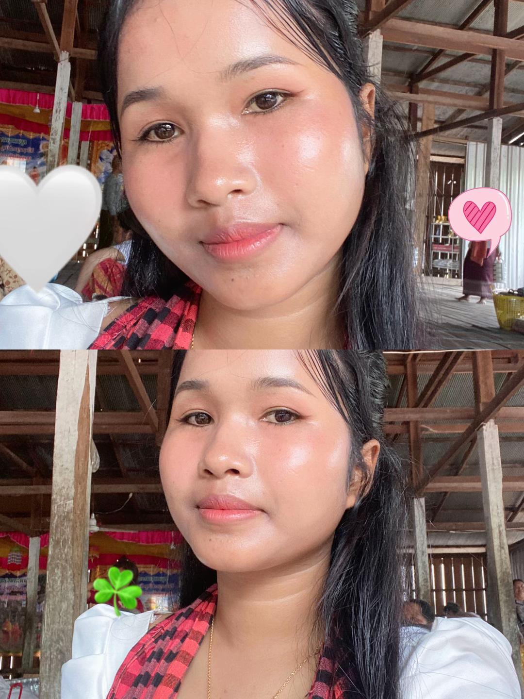 @Vicheka๐ฅ