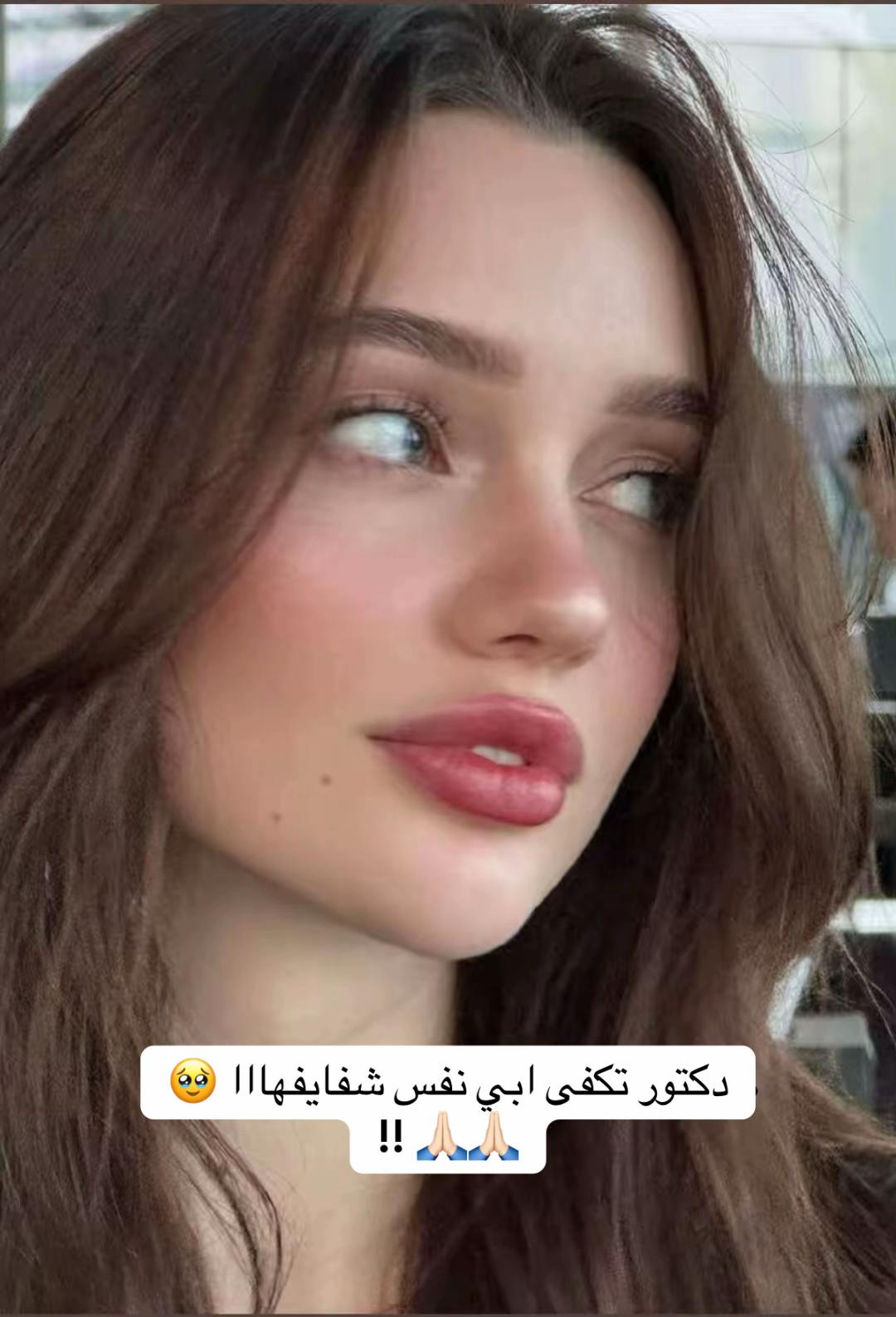 @Dr. Mohamed khier